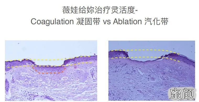 https://img.yiyiaimei.com/mnt/timg/201119/16295V447-5.jpg