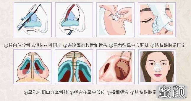 案例图片