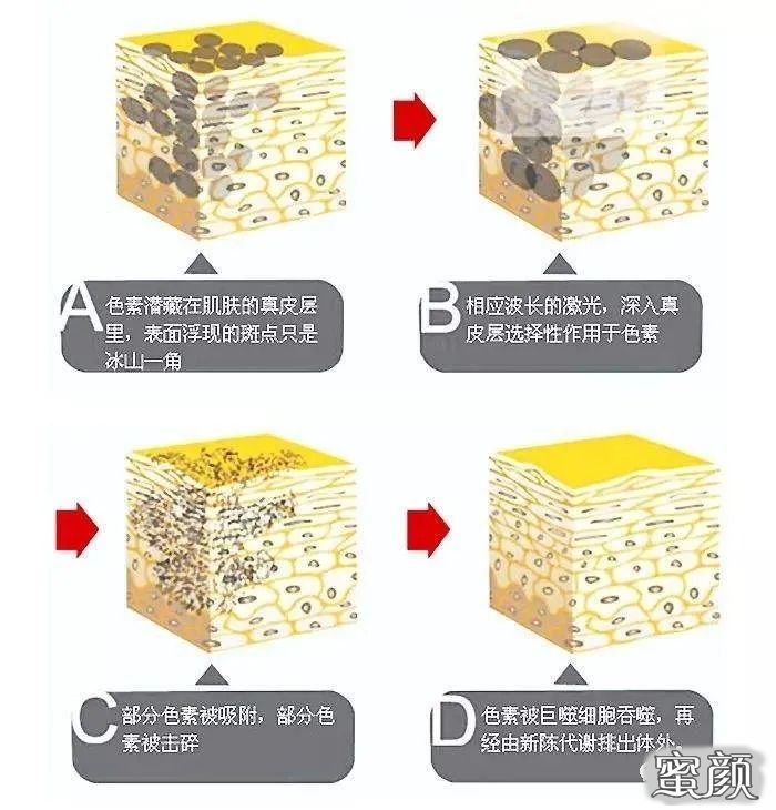 https://img.yiyiaimei.com/mnt/timg/201119/1S3102159-0.jpg