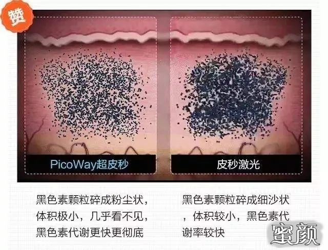 https://img.yiyiaimei.com/mnt/timg/201119/1S3114118-1.jpg