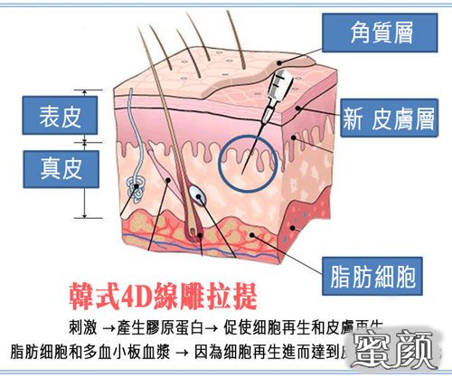 案例图片