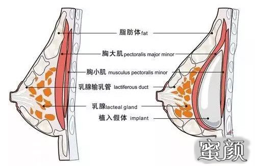 案例图片