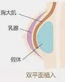 案例图片