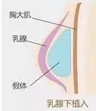 案例图片