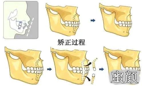 案例图片