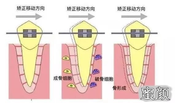 案例图片