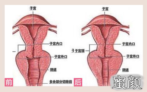 案例图片