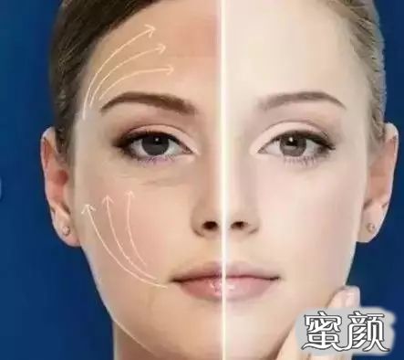 案例图片