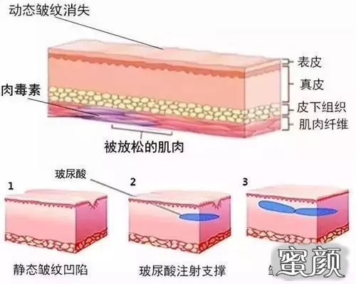 案例图片