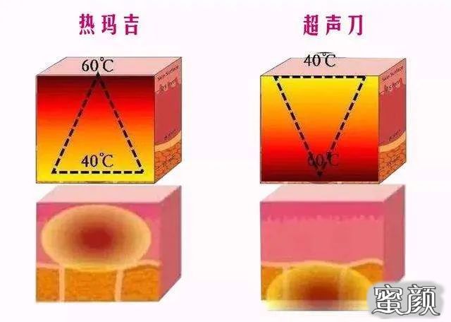 案例图片