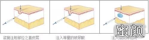 案例图片