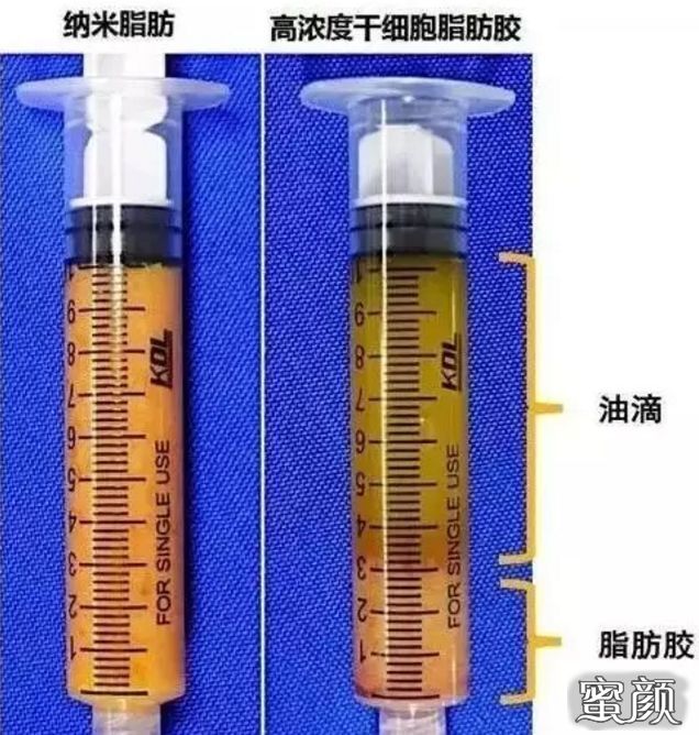 https://img.yiyiaimei.com/mnt/timg/201126/1U9394200-4.jpg