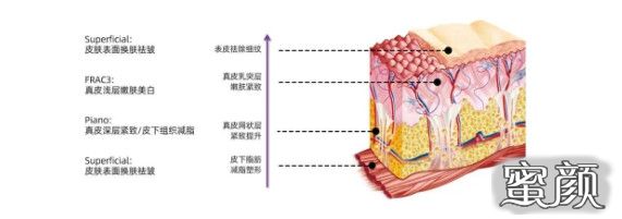 案例图片