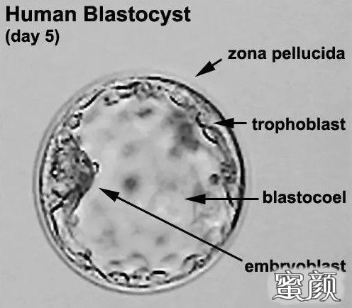 https://img.yiyiaimei.com/mnt/timg/201127/1500514c1-4.jpg