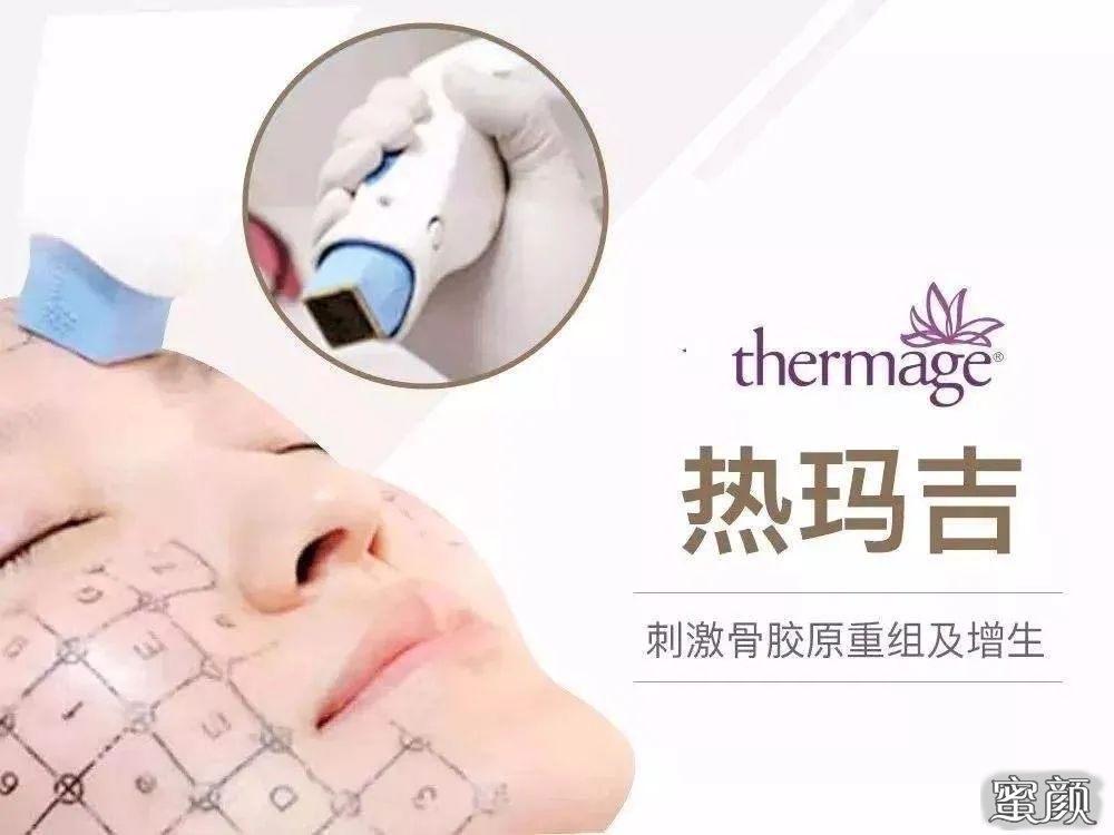 https://img.yiyiaimei.com/mnt/timg/201127/1A3424b0-0.jpg