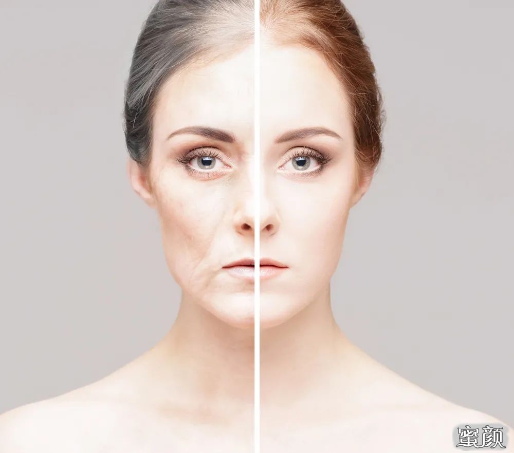 https://img.yiyiaimei.com/mnt/timg/201127/1A35J5B-2.jpg