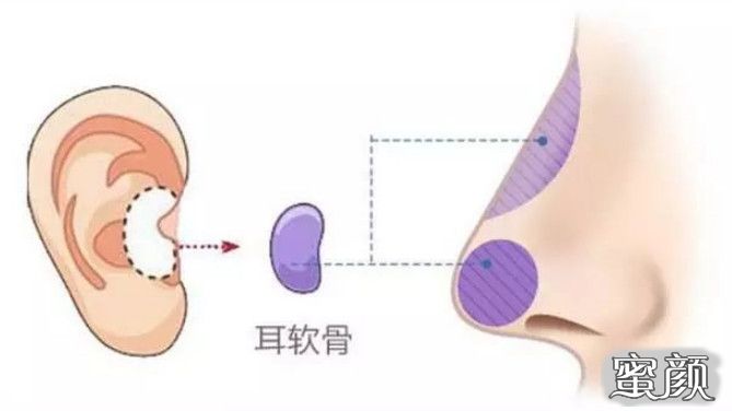 案例图片