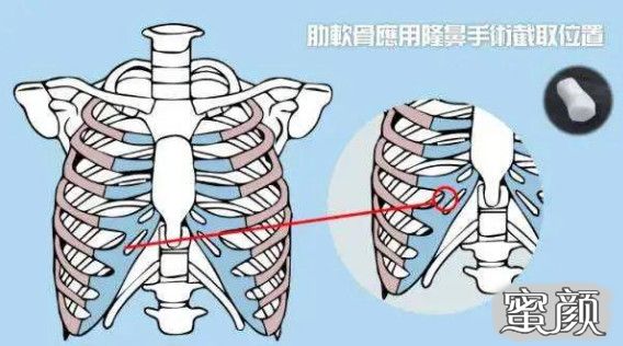 案例图片