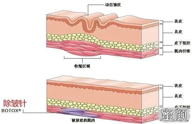 案例图片