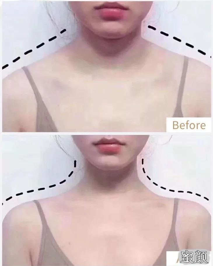 https://img.yiyiaimei.com/mnt/timg/201128/1223292163-4.jpg