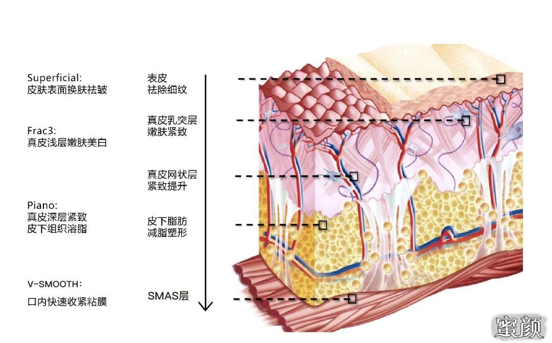 案例图片