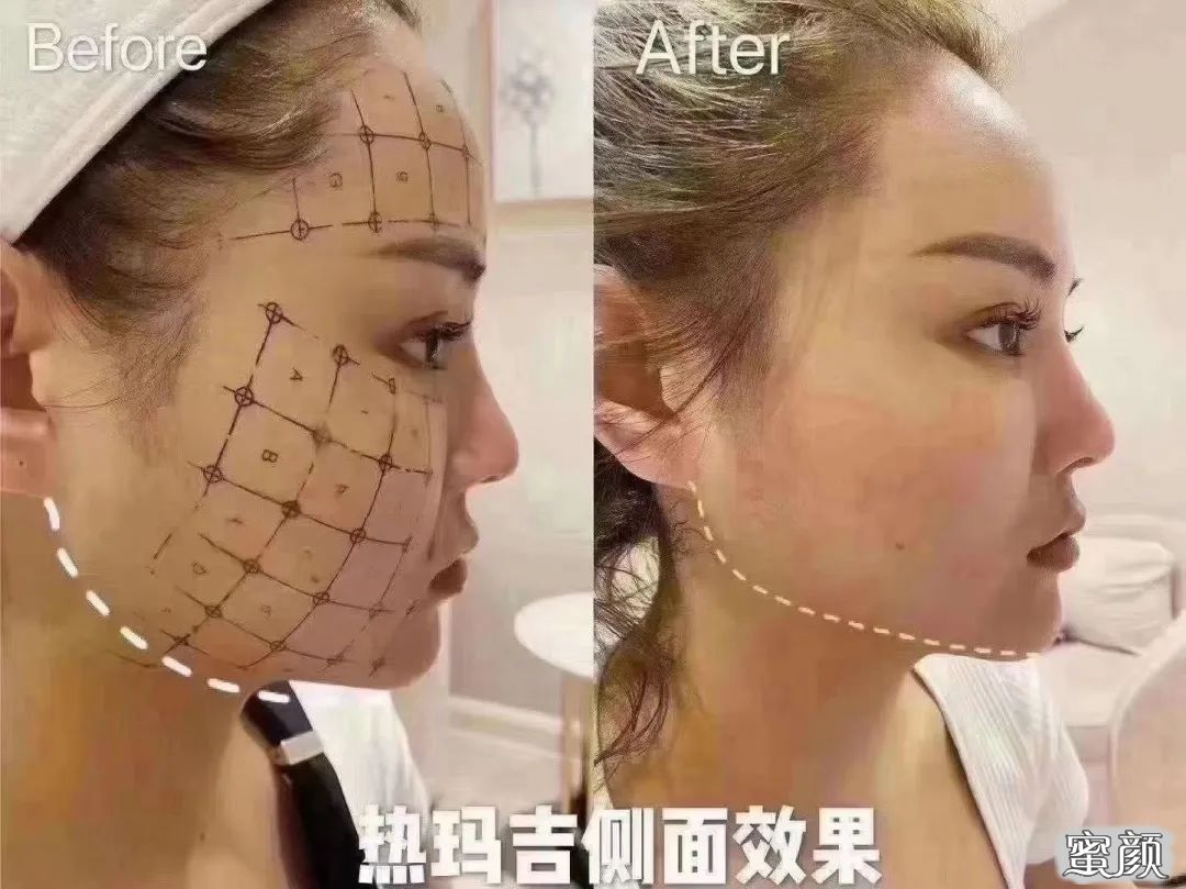 案例图片