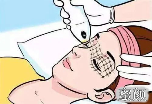 案例图片
