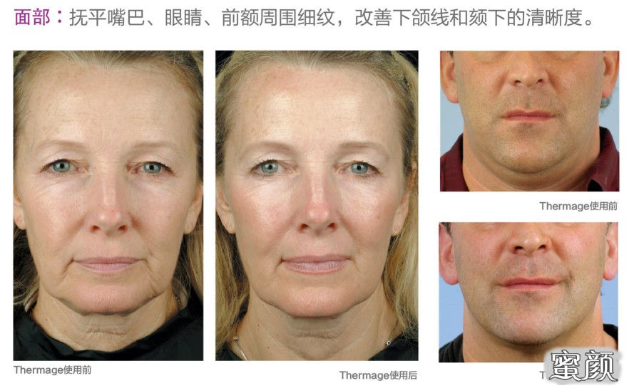 https://img.yiyiaimei.com/mnt/timg/201128/1913205H6-8.jpg