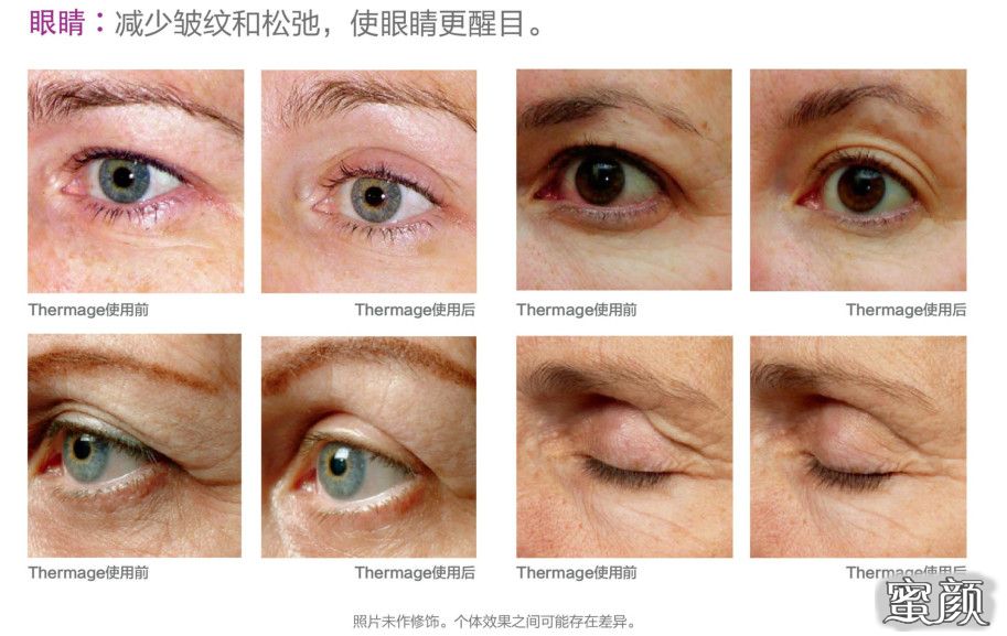 https://img.yiyiaimei.com/mnt/timg/201128/19132J094-9.jpg