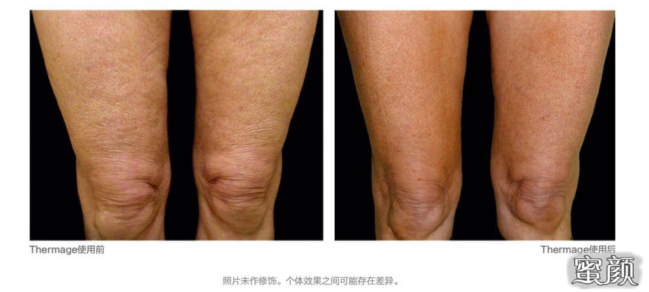https://img.yiyiaimei.com/mnt/timg/201128/1913355038-11.jpg