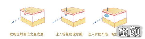 案例图片