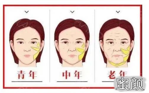 案例图片
