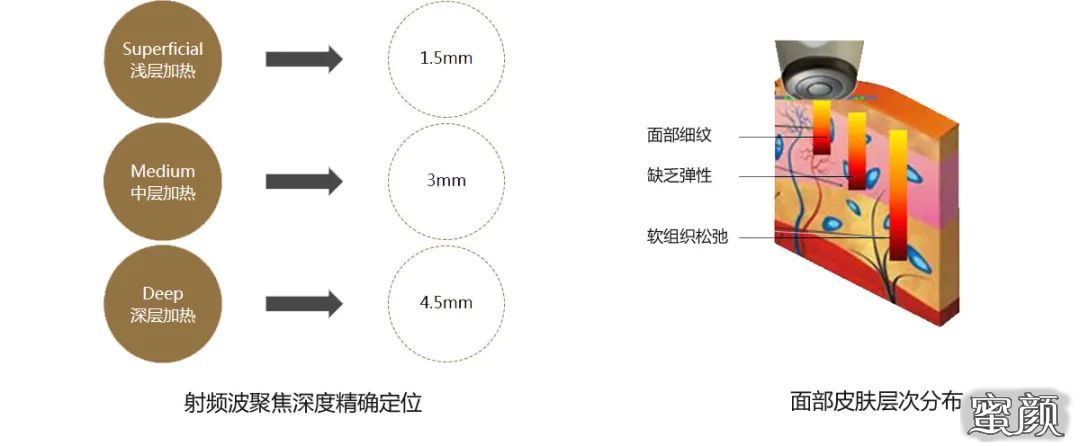 案例图片