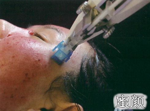 https://img.yiyiaimei.com/mnt/timg/201130/210035D64-3.jpg