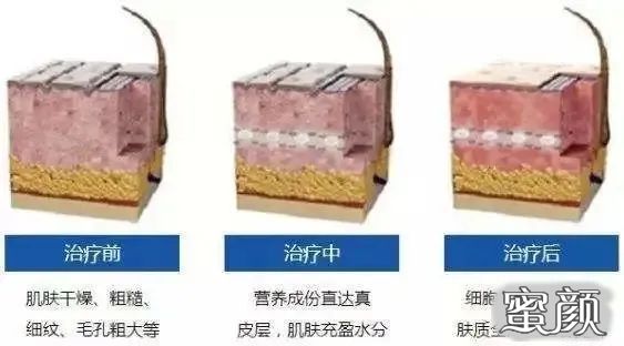 案例图片