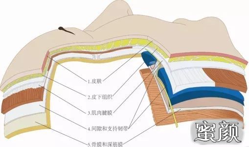 案例图片