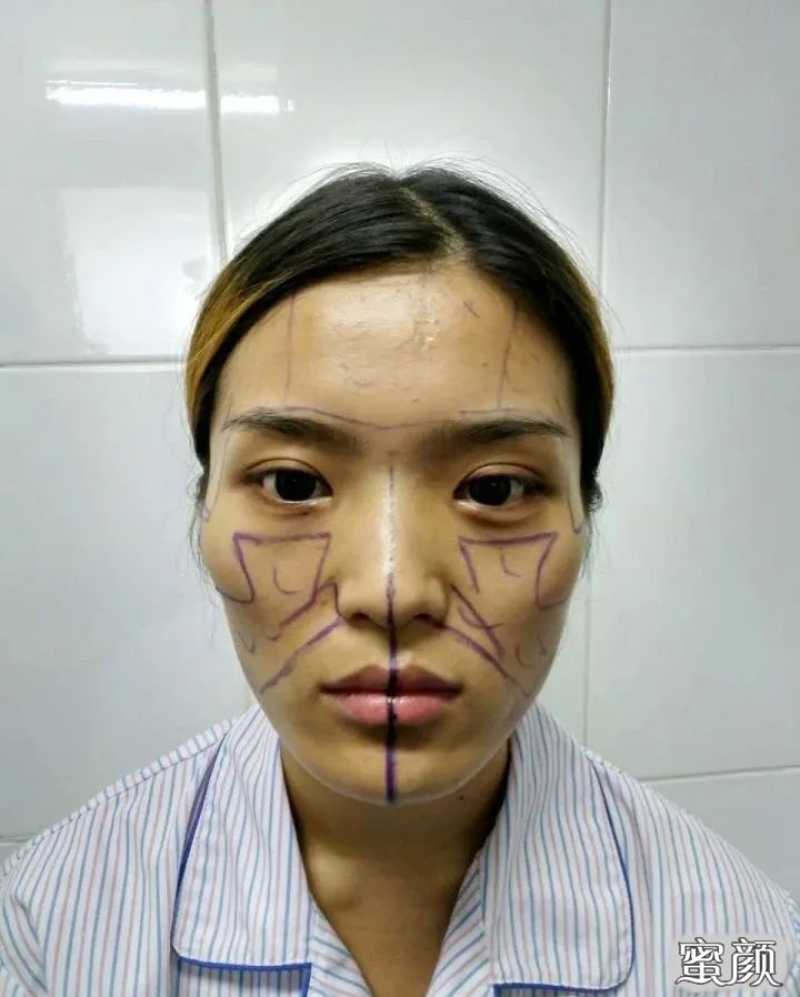 https://img.yiyiaimei.com/mnt/timg/201201/142Q15336-3.jpg
