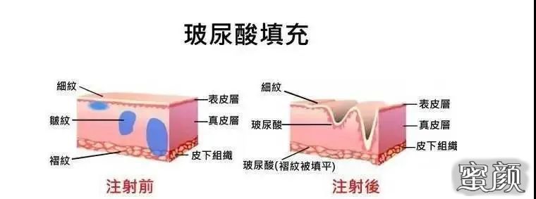 案例图片