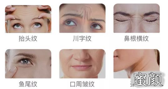 案例图片