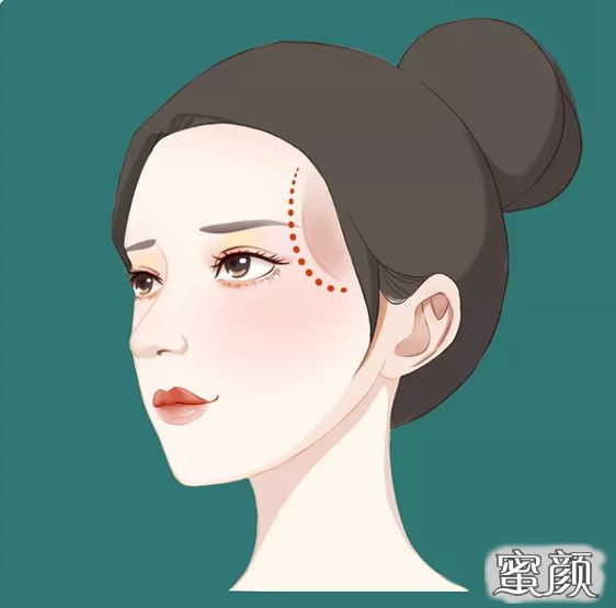 案例图片