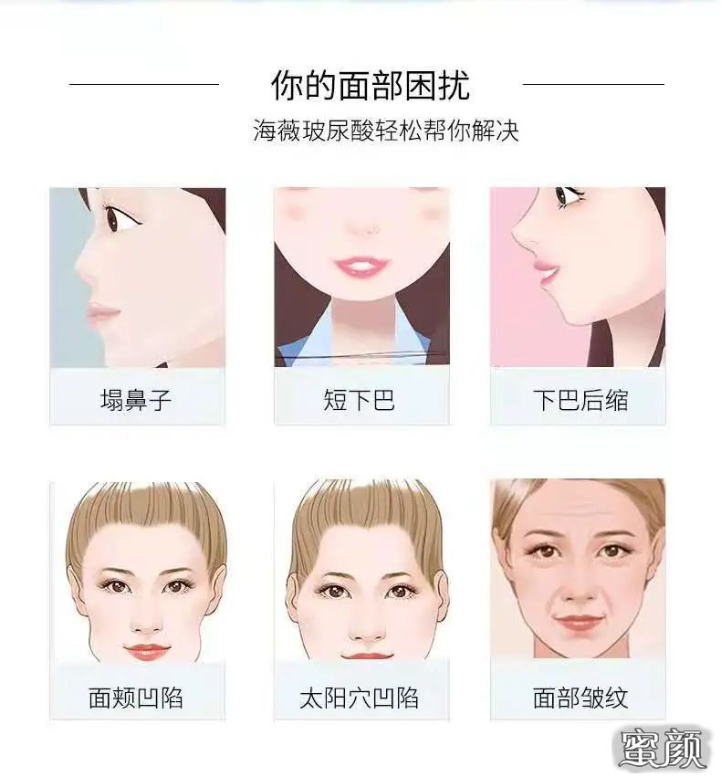 案例图片
