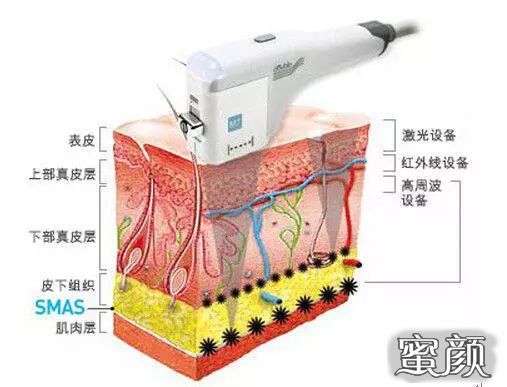 案例图片