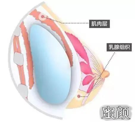 案例图片