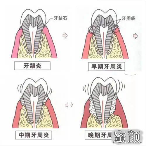 案例图片