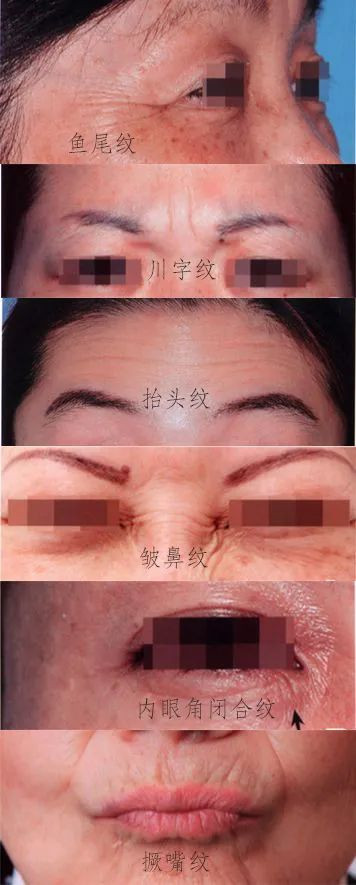 https://img.yiyiaimei.com/mnt/timg/201202/21462W150-1.jpg