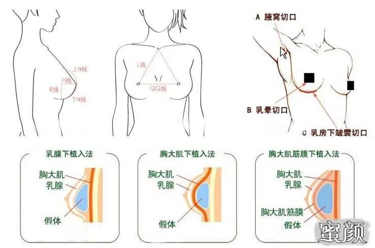 案例图片