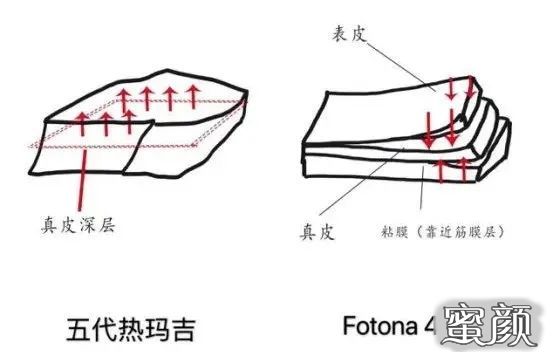 https://img.yiyiaimei.com/mnt/timg/201203/1213503015-2.jpg