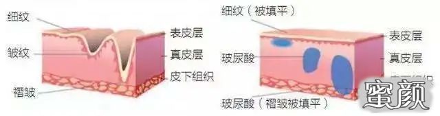 案例图片