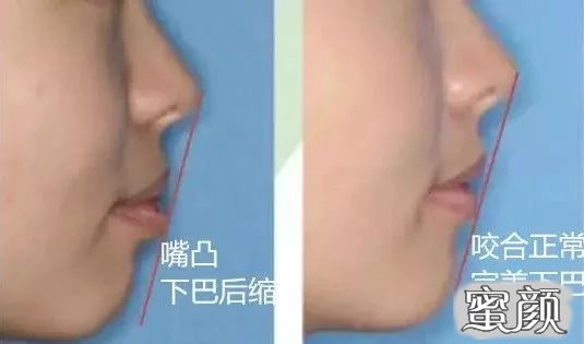 案例图片