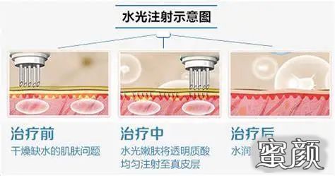 案例图片